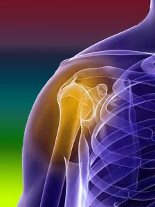 Виды переломов плечевого сустава