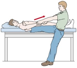 Вправление плечевого сустава - метод Гиппократа