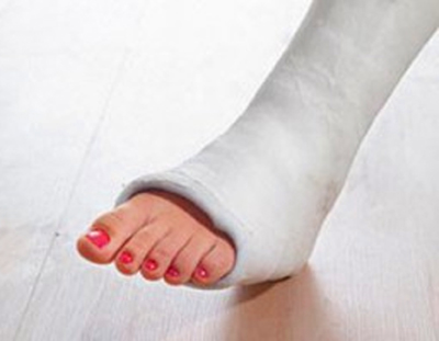 лечение перелома пятки