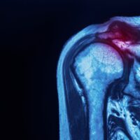 00955b2e2e27f89345f4c6b0054b42c6