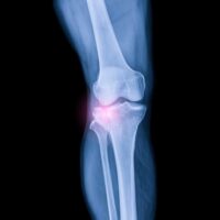 3c6de5905c43a3df66bad4942389a6d9