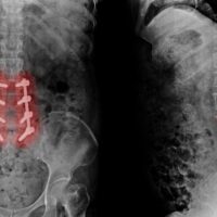 807e62c5d34dbe5b6a28527ea034290a