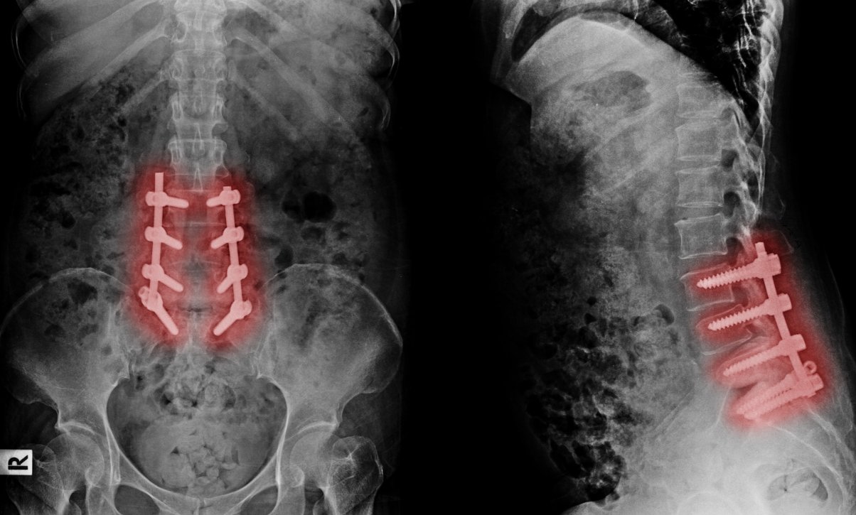 807e62c5d34dbe5b6a28527ea034290a